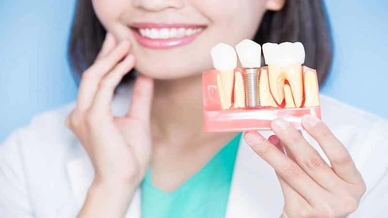 Affordable Dental Implants Near Me : Find a Clinic Now